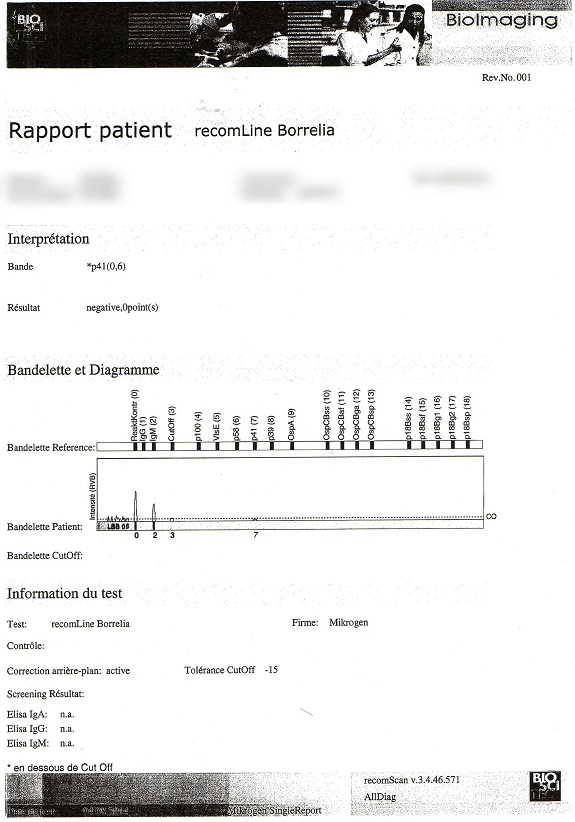 borrelia22.jpg