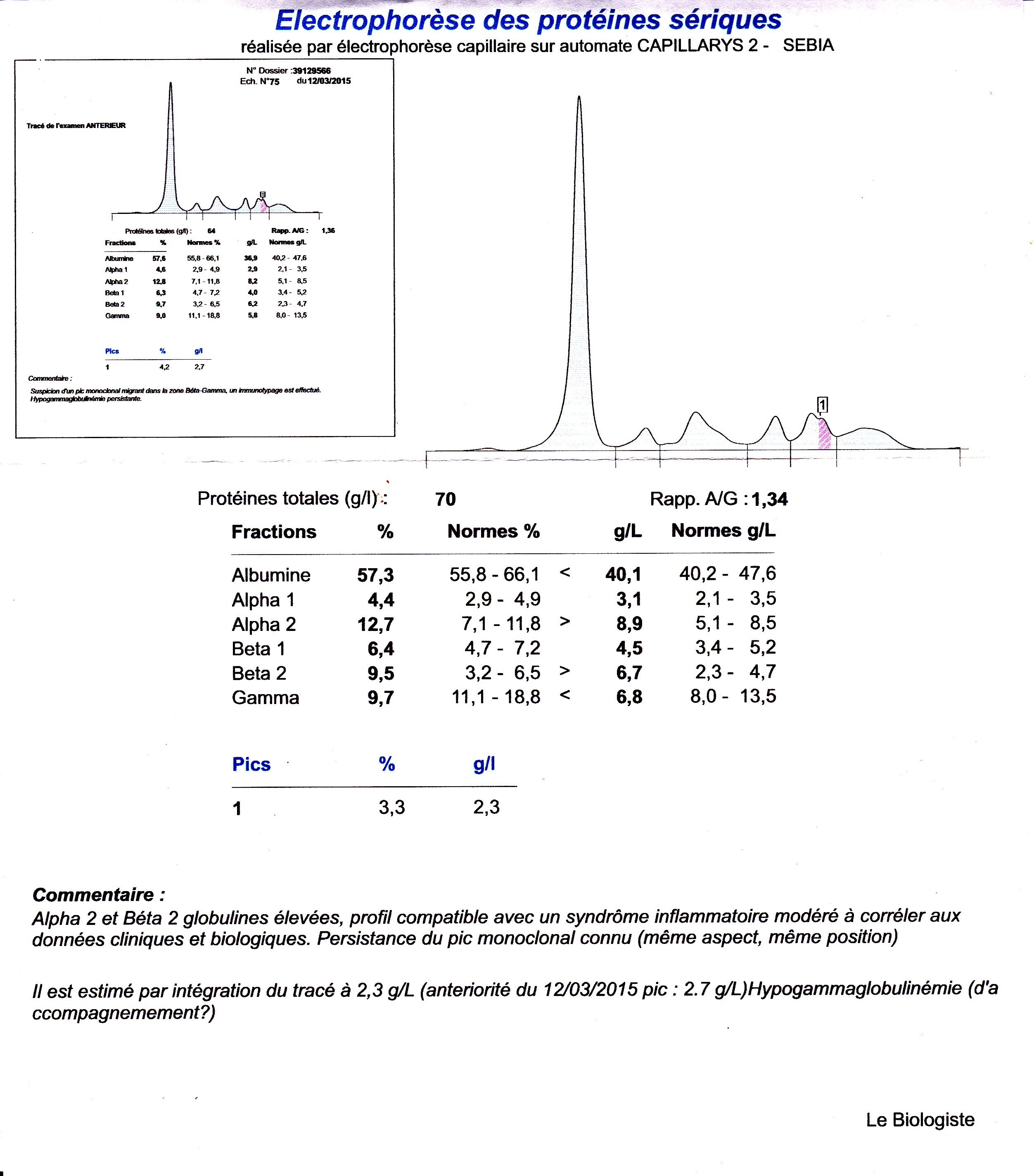 electrophorèse.jpg