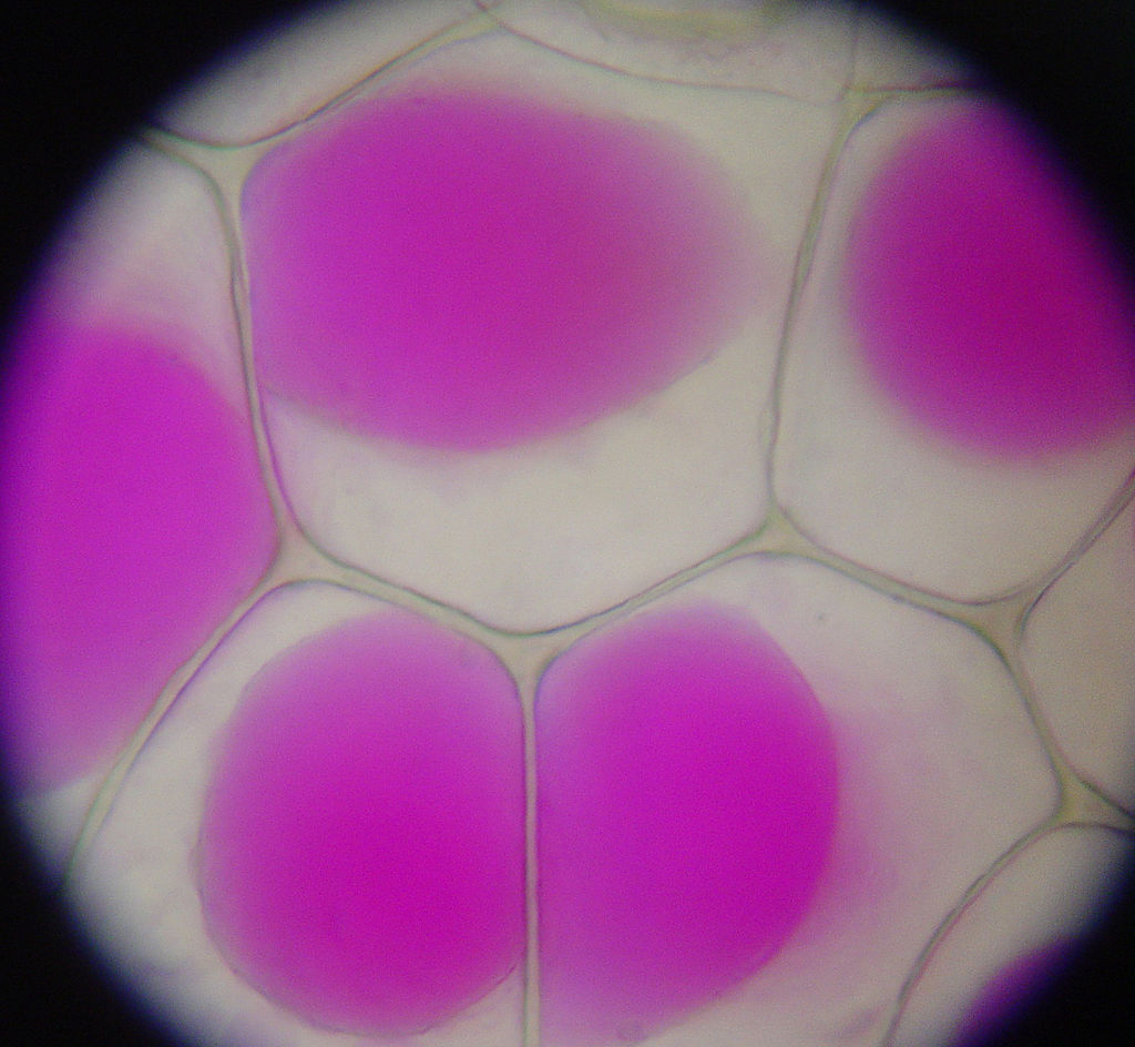 1024px-Rhoeo_Discolor_-_Plasmolysis.jpg